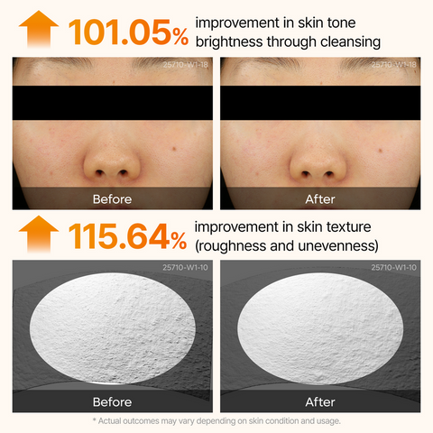 Kojic Acid Turmeric Brightening Routine Duo