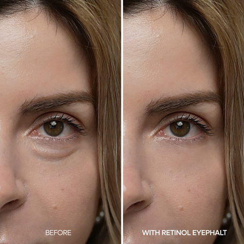 Retinol Eyebag Cream