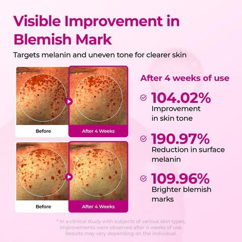 TikTok Bestseller | Firming & Collagen Boosting 5-Step Skincare Gift Set