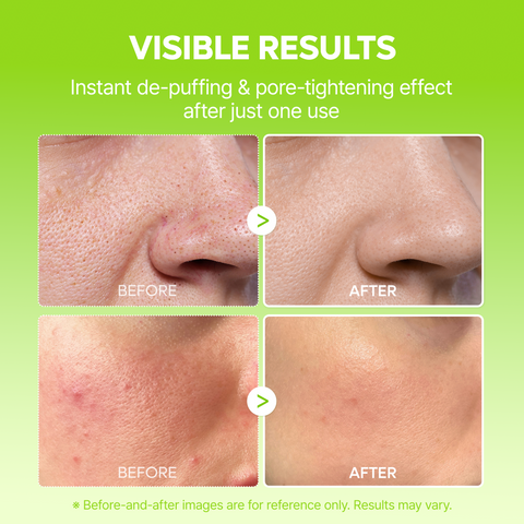 CACTOX Pore Relief Jelly Serum Mist