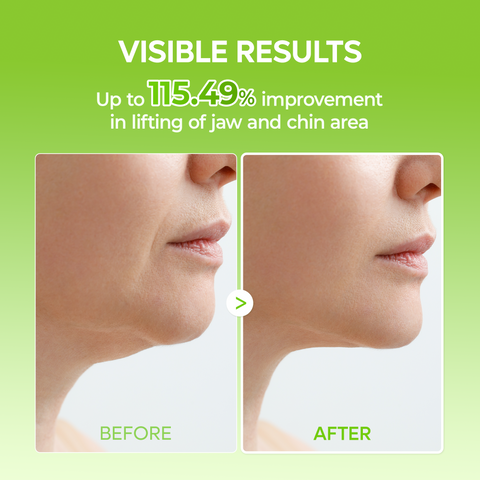 [Out of Stock] CACTOX V-Lifting Mewing Band 4EA