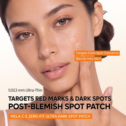 Zero-Fit Blemish & Dark Spot Patch Duo (144 Patches)