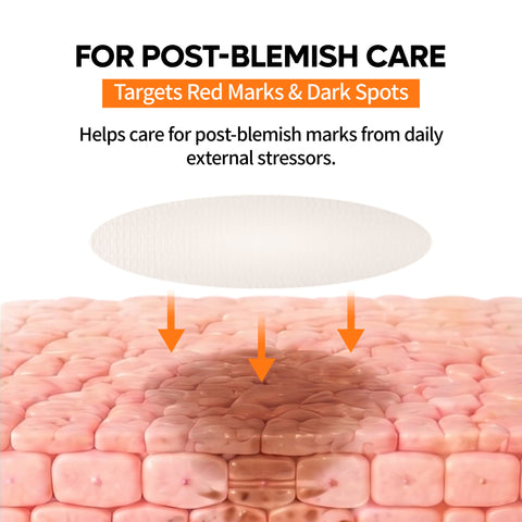 Zero-Fit Blemish & Dark Spot Patch Duo (144 Patches)