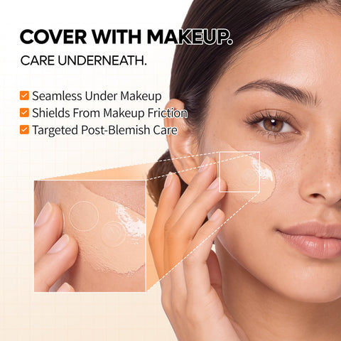 Zero-Fit Blemish & Dark Spot Patch Duo (144 Patches)