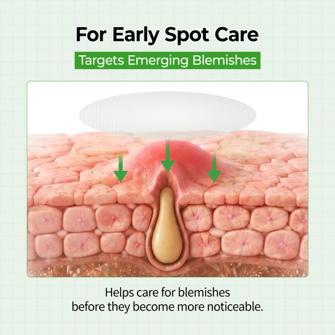 Zero-Fit Blemish & Dark Spot Patch Duo (144 Patches)